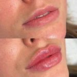 کلینیک زیبایی و لیزر رولا