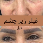 کلینیک پوست مو لیزر لاغری زیباریس