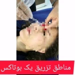 تصویر دکتر زیبایی بوتاکس دکتر شیرین امیر حسنی