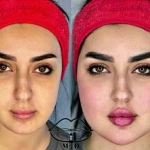 تصویر کلینیک زیبایی بلا