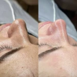 فیشال تخصصی و درمانی میسون