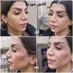 کلینیک زیبایی و لیزر مو گندم