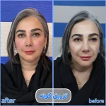برفین اسکین