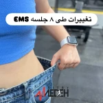 لوگوی باشگاه ای ام اس (ایکسبادی) پیروزی