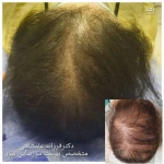 تصویر متخصص پوست مو زیبایی لیزر دکتر فرزانه علمشاهی