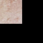 نمونه کار لاوین اسکین کر