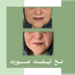کلینیک زیبایی دکتر لامعی