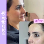 کلینیک پوست موزیبایی ولیزر(بانوان) فرتاب