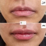 دکتر بهاره ملکی متخصص پوست ، مو و زیبایی