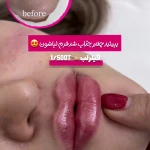 مرکز لیزر و کلینیک زیبایی پریفا
