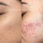 نمونه کار مرکز پوست و مو  معجزه گر