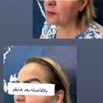 کلینیک تخصصی لیزر و زیبایی آیرین