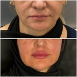 نمونه کار مطب زیبایی لیانارخ