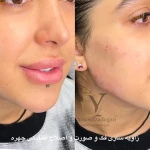 کلینیک زیبایی دکتر یوسف زادگان