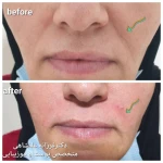 متخصص پوست مو زیبایی لیزر دکتر فرزانه علمشاهی