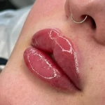 کلینیک پوست و مووزیبایی دالیا