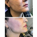 کلینیک لیزر پوست و مو زیبایی توکا