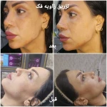 کلینیک زیبایی و لیزر مو گندم
