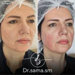 مطب پوست و مو زیبایی دکتر سما