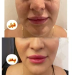 مرکز پوست مو زیبایی رز طلایی