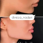 مرکز زیبایی و لیزر دکتر رضا نادری