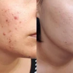 کلینیک  پوست ومو و  زیبایی لیدیا