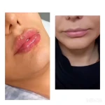 کلینیک زیبایی پارسیان آلفا