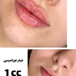 تصویر کلنیک پوست مو زیبای لیزر هیوا