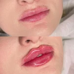 نمونه کار کلینیک زیبایی ریجینا
