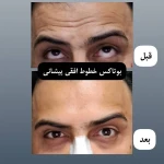  کلینیک لیزر و زیبایی راشا