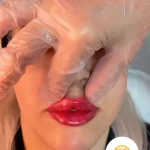 کلینیک زیبایی و مرکز لیزر و هایفو مرکز دلورا