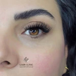 مرکز تخصصی کاشت و اکستنشن مژه شکوفه