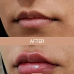 کلینیک زیبایی و لیزر مو دکتر سمانه وطن دوست