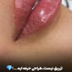 مرکز لیزر کلینیک زیبایی رزنیلای مرزداران