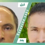 تصویر کلینیک تخصصی کاشت مو و ابرو رویش سبز