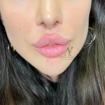 کلینیک زیبایی دکتر یوسف زادگان