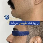 مرکز لیزر کلینیک زیبایی رزنیلای مرزداران