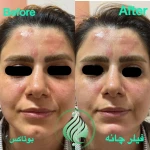تصویر کلینیک پوست مو زیبایی و لاغری باران