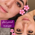کاشت مژه و لیفت ابرو فرناز