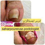 نمونه کار لیزر،پوست،زیبایی سحر پورایواز