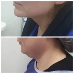 متخصص پوست مو زیبایی لیزر دکتر فرزانه علمشاهی