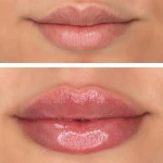 تصویر کلینیک پوست مو زیبایی و لیزر ونوشه