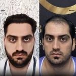 کلینیک زیبایی تهران بیوتی سنتر