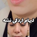 کلینیک لیزر لاغری فشیال پلاژن فیلربوتاکس