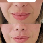 مرکز لیزر موهای زائد و پاکسازی پوست نوترسا