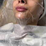 پاکسازی پوست کلینیک پوست تمیس