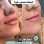 مجموعه زیبایی فلورا پوست مو زیبایی