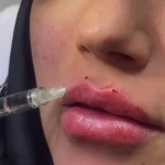 تصویر کلینیک  پوست مو زیبایی و لیزر ویان