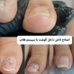 پدیکور و پودولوژیSD