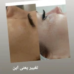 خدمات تخصصی پوست و مو مریم نصیرپور